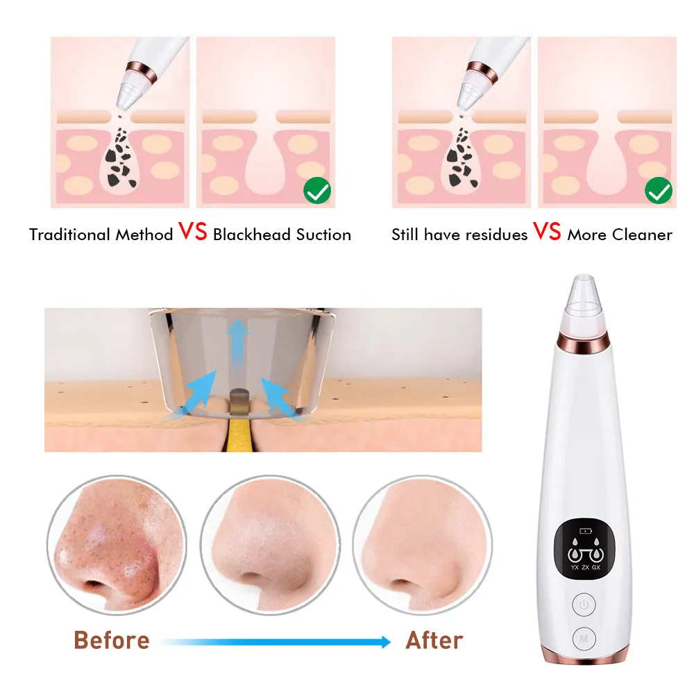 Vacuum Pore Cleaner Skin Care New Standard